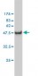 CA3 Antibody (monoclonal) (M02)